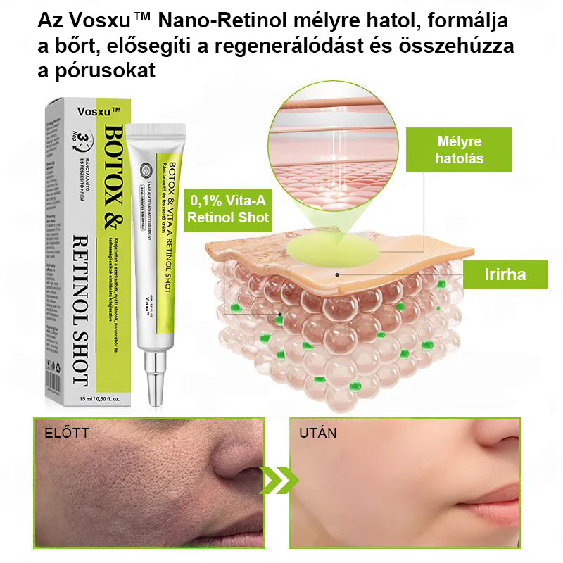 ✨ Vosxu™ Botox & Vita-A Retinol Shot ráncfelvarró szérum ✨ – 💉 Mikro-tűk | 💪 Botox-szerű peptidek | 🌿 Retinol | ⚡ Látható eredmények már 3 nap alatt