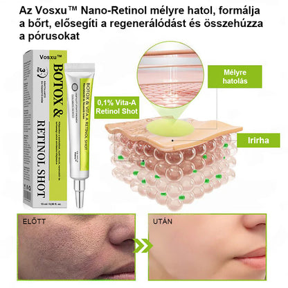 ✨ Vosxu™ Botox & Vita-A Retinol Shot ráncfelvarró szérum ✨ – 💉 Mikro-tűk | 💪 Botox-szerű peptidek | 🌿 Retinol | ⚡ Látható eredmények már 3 nap alatt