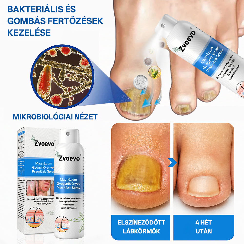 Zvevo® Magnézium Gyógynövényes Pikkelysömör Spray – Természetes bőrregeneráló megoldás viszketés, bőrpír és ekcéma ellen | 💧 Gyors felszívódás | 🚫 Szteroidmentes formula | ✨ Érzékeny és intim bőrre is
