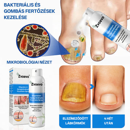 Zvevo® Magnézium Gyógynövényes Pikkelysömör Spray – Természetes bőrregeneráló megoldás viszketés, bőrpír és ekcéma ellen | 💧 Gyors felszívódás | 🚫 Szteroidmentes formula | ✨ Érzékeny és intim bőrre is