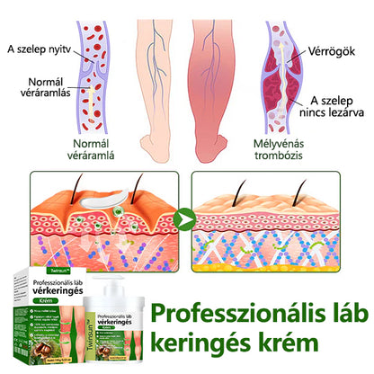 🌿 Mondjon búcsút a duzzadt, fájó lábaknak – Twinsun™ FluidEase Professional Lábkeringési Krém hozza a valódi megkönnyebbülést! ✨🦵