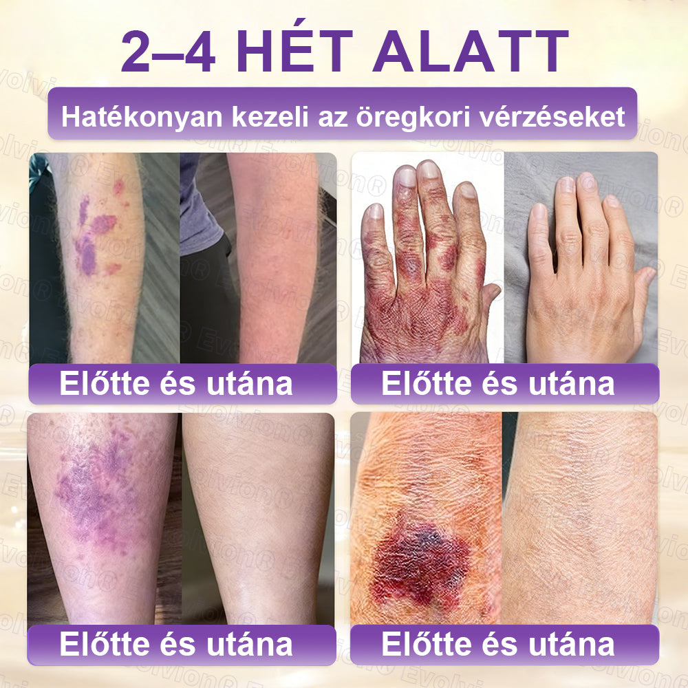 COLTURE® Biotin 10 az 1-ben bőrmegújító krém ✨ öregedés, pikkelysömör, akné, hegek, pigmentfoltok, szárazság, gyulladás és intim kellemetlenségek ellen 🌿 természetes bioaktív összetevőkkel 💧 a sima, feszes és fiatalos bőrért