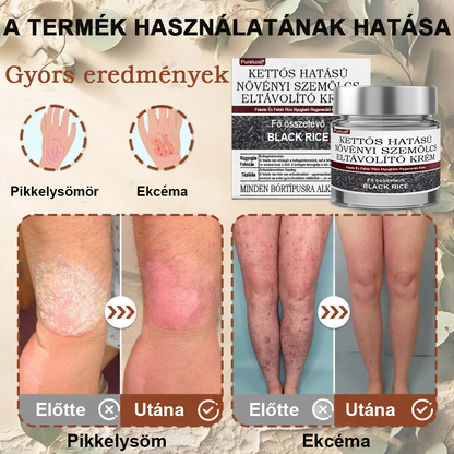 🌿 Pureluxo® Fekete Rizses Bőrregeneráló Esszenciakrém ✨ Szemölcsök, Bőrkinövések és Bőrhibák Célzott Ápolására
