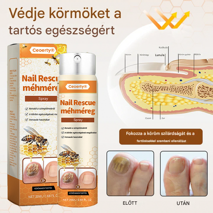 💥 2026 Korlátozott 70% KEDVEZMÉNY ️⏳ Ceoerty® NailRescue Kolirin méhméreg körömgomba spray 💥 Minden körömproblémát orvosolhatsz 2 héten belül🌿🌿