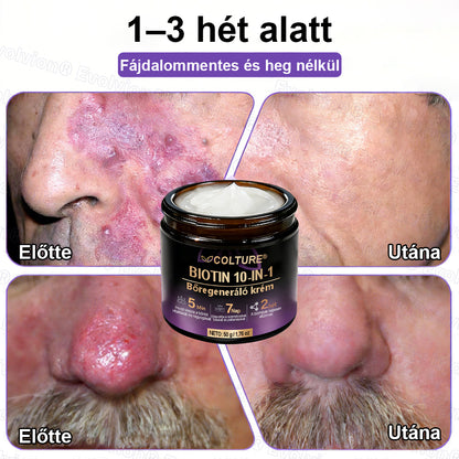 COLTURE® Biotin 10 az 1-ben bőrmegújító krém ✨ öregedés, pikkelysömör, akné, hegek, pigmentfoltok, szárazság, gyulladás és intim kellemetlenségek ellen 🌿 természetes bioaktív összetevőkkel 💧 a sima, feszes és fiatalos bőrért