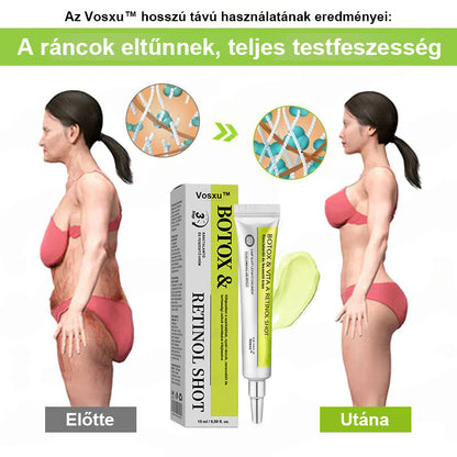 ✨ Vosxu™ Botox & Vita-A Retinol Shot ráncfelvarró szérum ✨ – 💉 Mikro-tűk | 💪 Botox-szerű peptidek | 🌿 Retinol | ⚡ Látható eredmények már 3 nap alatt