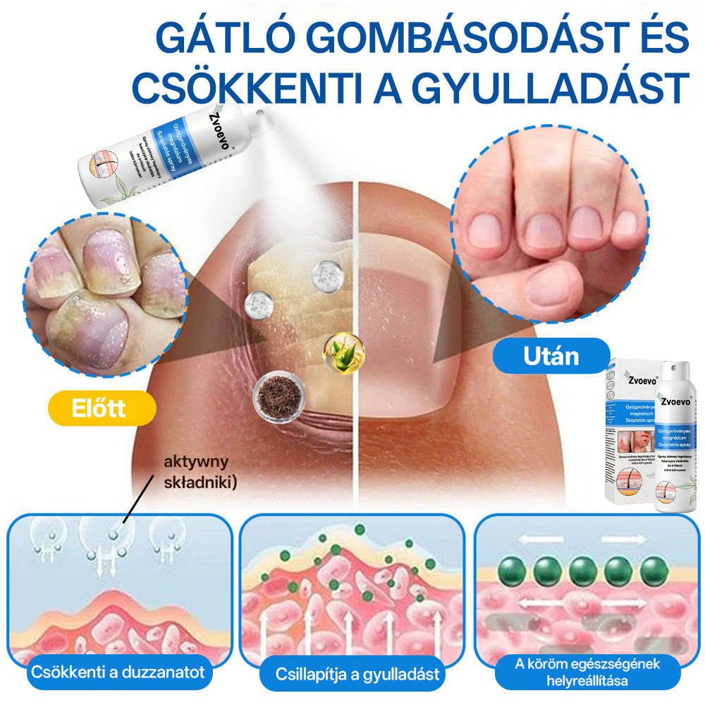Zvevo® Magnézium Gyógynövényes Pikkelysömör Spray – Természetes bőrregeneráló megoldás viszketés, bőrpír és ekcéma ellen | 💧 Gyors felszívódás | 🚫 Szteroidmentes formula | ✨ Érzékeny és intim bőrre is