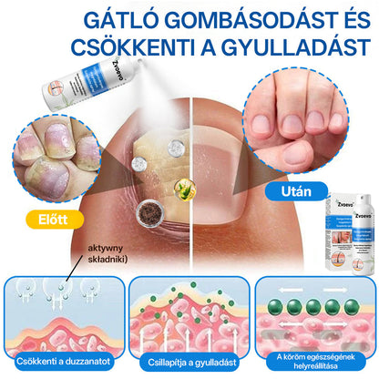 Zvevo® Magnézium Gyógynövényes Pikkelysömör Spray – Természetes bőrregeneráló megoldás viszketés, bőrpír és ekcéma ellen | 💧 Gyors felszívódás | 🚫 Szteroidmentes formula | ✨ Érzékeny és intim bőrre is