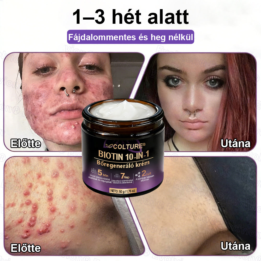 COLTURE® Biotin 10 az 1-ben bőrmegújító krém ✨ öregedés, pikkelysömör, akné, hegek, pigmentfoltok, szárazság, gyulladás és intim kellemetlenségek ellen 🌿 természetes bioaktív összetevőkkel 💧 a sima, feszes és fiatalos bőrért