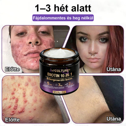 COLTURE® Biotin 10 az 1-ben bőrmegújító krém ✨ öregedés, pikkelysömör, akné, hegek, pigmentfoltok, szárazság, gyulladás és intim kellemetlenségek ellen 🌿 természetes bioaktív összetevőkkel 💧 a sima, feszes és fiatalos bőrért