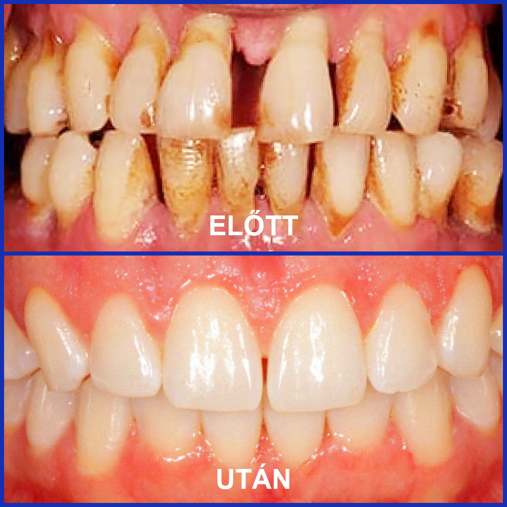 🌟 Rolimey® VioCore Propolisz fogkrém 🦷 Fogfájás enyhítése 3 nap alatt · 7 napos ínyregeneráció · Parodontális betegségek megelőzése · Méhméreg és természetes ásványi anyagok tökéletes kombinációja 🌟