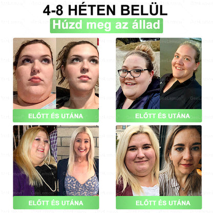 𝐆𝐞𝑒𝐿𝑒𝐦𝐨𝐧® Glumasetide 8 az 1-ben Karcsú és Egészséges Nano Mikrotűs Tapasz (👩🏻‍⚕️ KÜLÖNLEGES KIÁRUSÍTÁS – UTOLSÓ NAP | 80 % KEDVEZMÉNY 🔥)