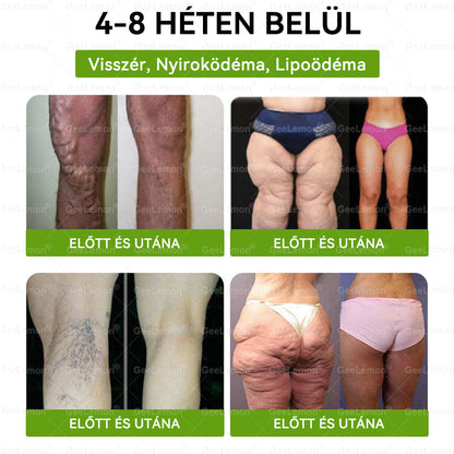 𝐆𝐞𝑒𝐿𝑒𝐦𝐨𝐧® Glumasetide 8 az 1-ben Karcsú és Egészséges Nano Mikrotűs Tapasz (👩🏻‍⚕️ KÜLÖNLEGES KIÁRUSÍTÁS – UTOLSÓ NAP | 80 % KEDVEZMÉNY 🔥)