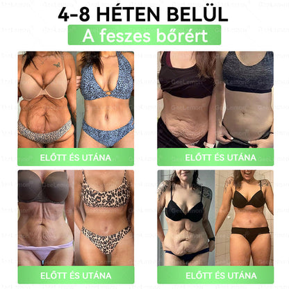 𝐆𝐞𝑒𝐿𝑒𝐦𝐨𝐧® Glumasetide 8 az 1-ben Karcsú és Egészséges Nano Mikrotűs Tapasz (👩🏻‍⚕️ KÜLÖNLEGES KIÁRUSÍTÁS – UTOLSÓ NAP | 80 % KEDVEZMÉNY 🔥)